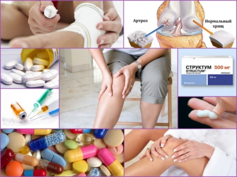 Лечение артрита и артроза препараты