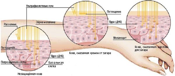 Влияние ультрафиолета на кожу