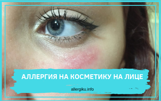 аллергия на косметику на лице